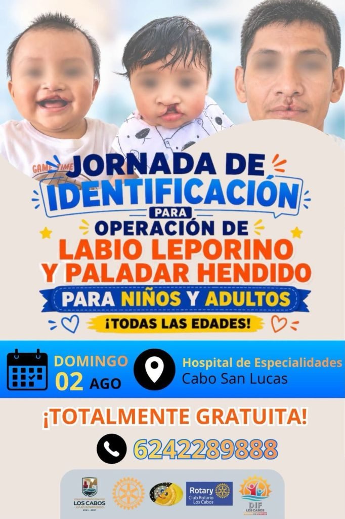 Invita DIF Los Cabos a Jornada de Identificación para Operación de Labio Leporino y Paladar Hendido